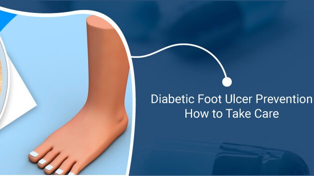 Diabetic-Foot-Ulcer-Prevention