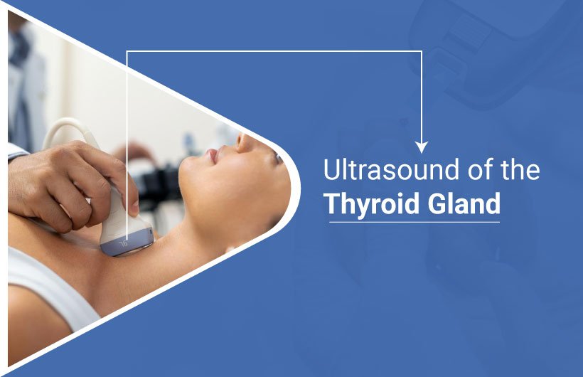 ultrasound of the thyroid gland