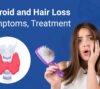 Thyroid-and-Hair-Loss-Symptoms-Treatment