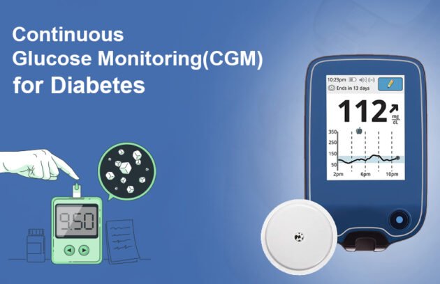 Glucose Monitoring for Diabetes