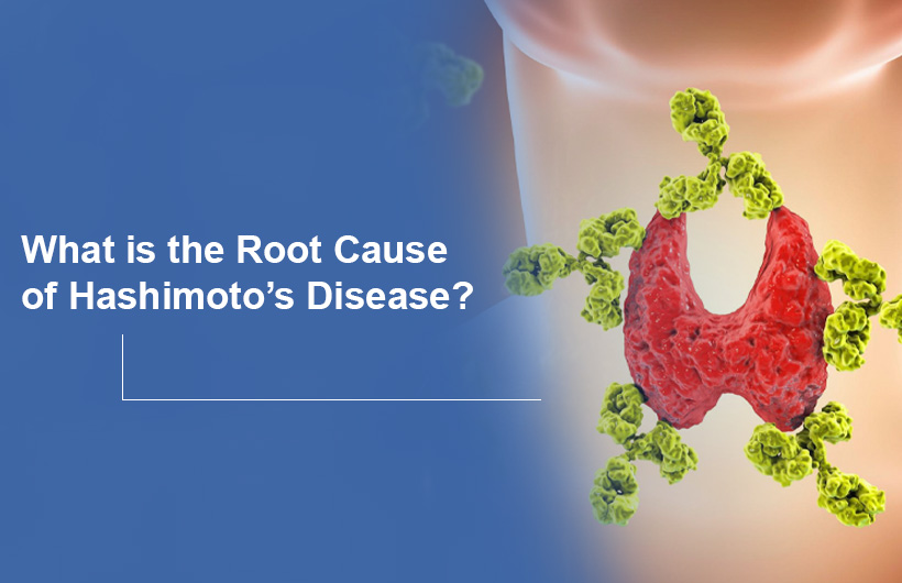 What is the Root Cause of Hashimoto's Disease?