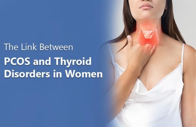 Link Between PCOS and Thyroid Disorders in Women