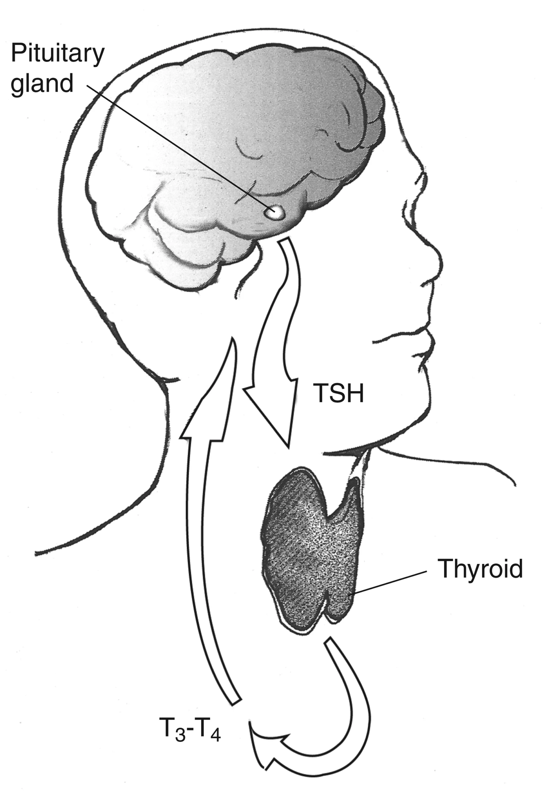 Thyroid gland medical illustration for a guide to choosing a thyroid specialist in Ahmedabad