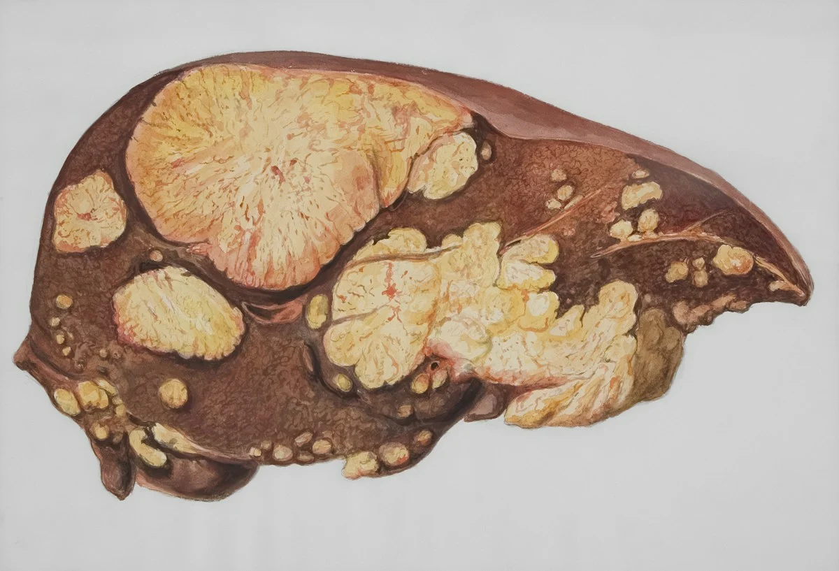 Medical illustration of the liver for a fatty liver and MASLD article