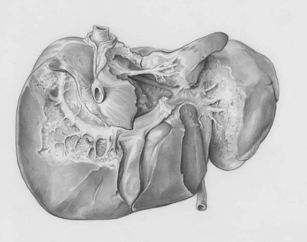 Medical liver illustration for comparing FibroScan and ultrasound elastography in Fatty Liver