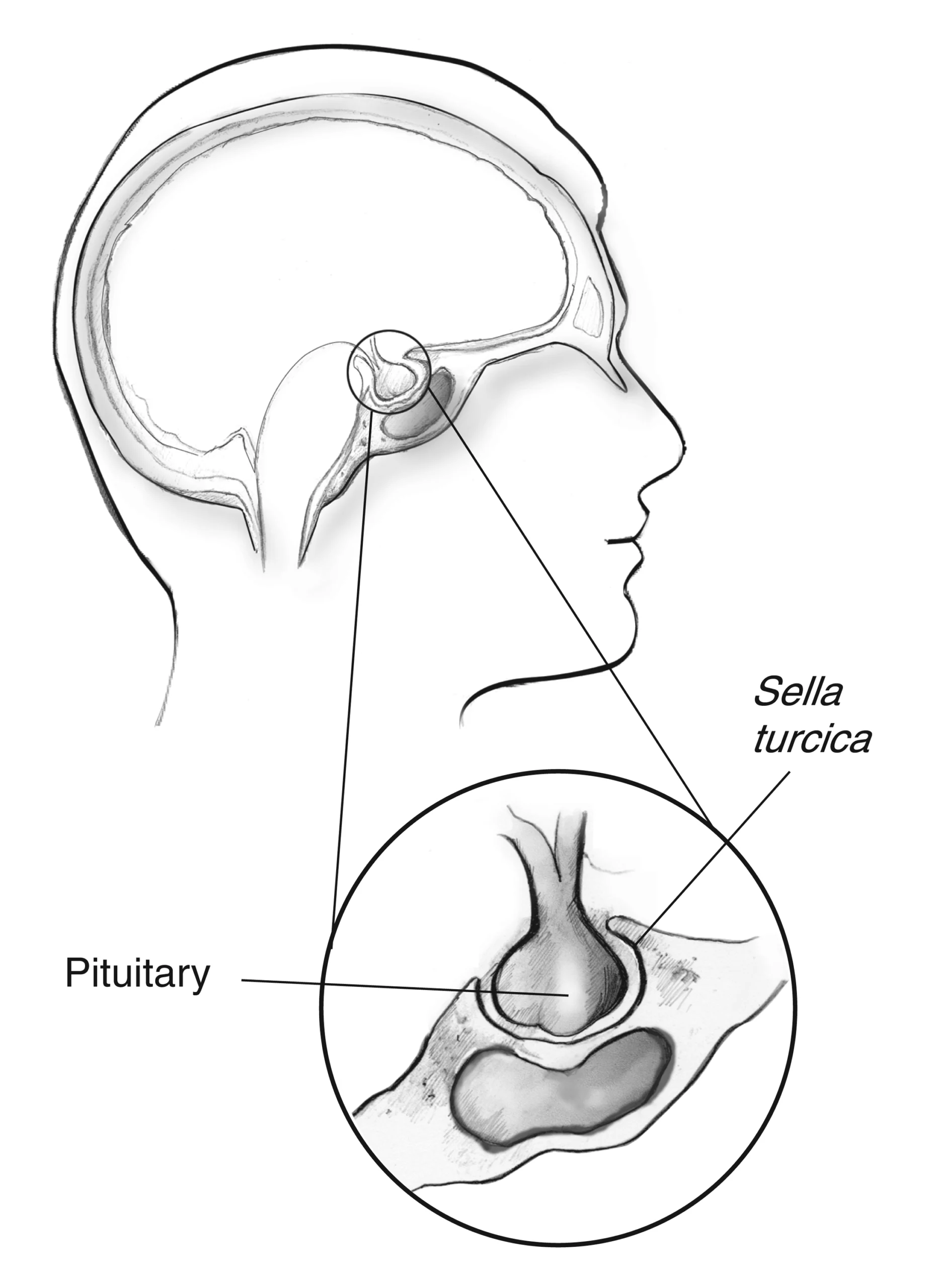 Medical illustration showing the pituitary gland in the sella turcica at the base of the brain