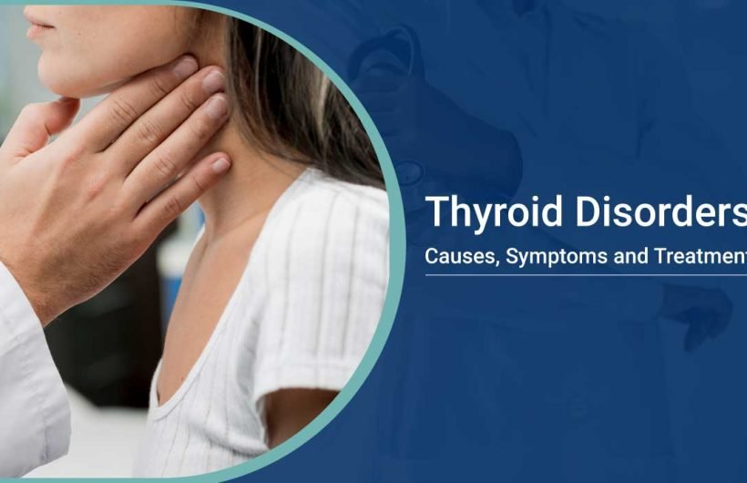 Thyroid Disorders treatment