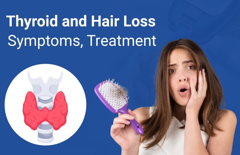 Thyroid and Hair Loss