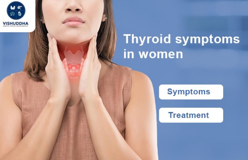 Thyroid symptoms in women