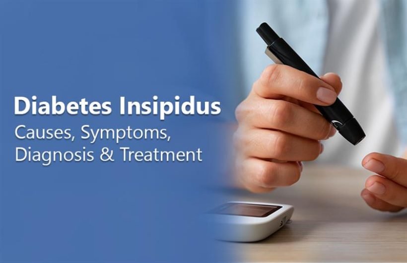 What is Diabetes Insipidus What is Diabetes Insipidus